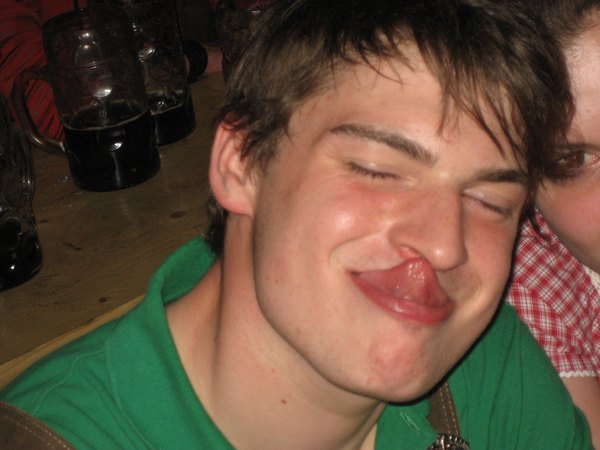 braeu_7.jpg